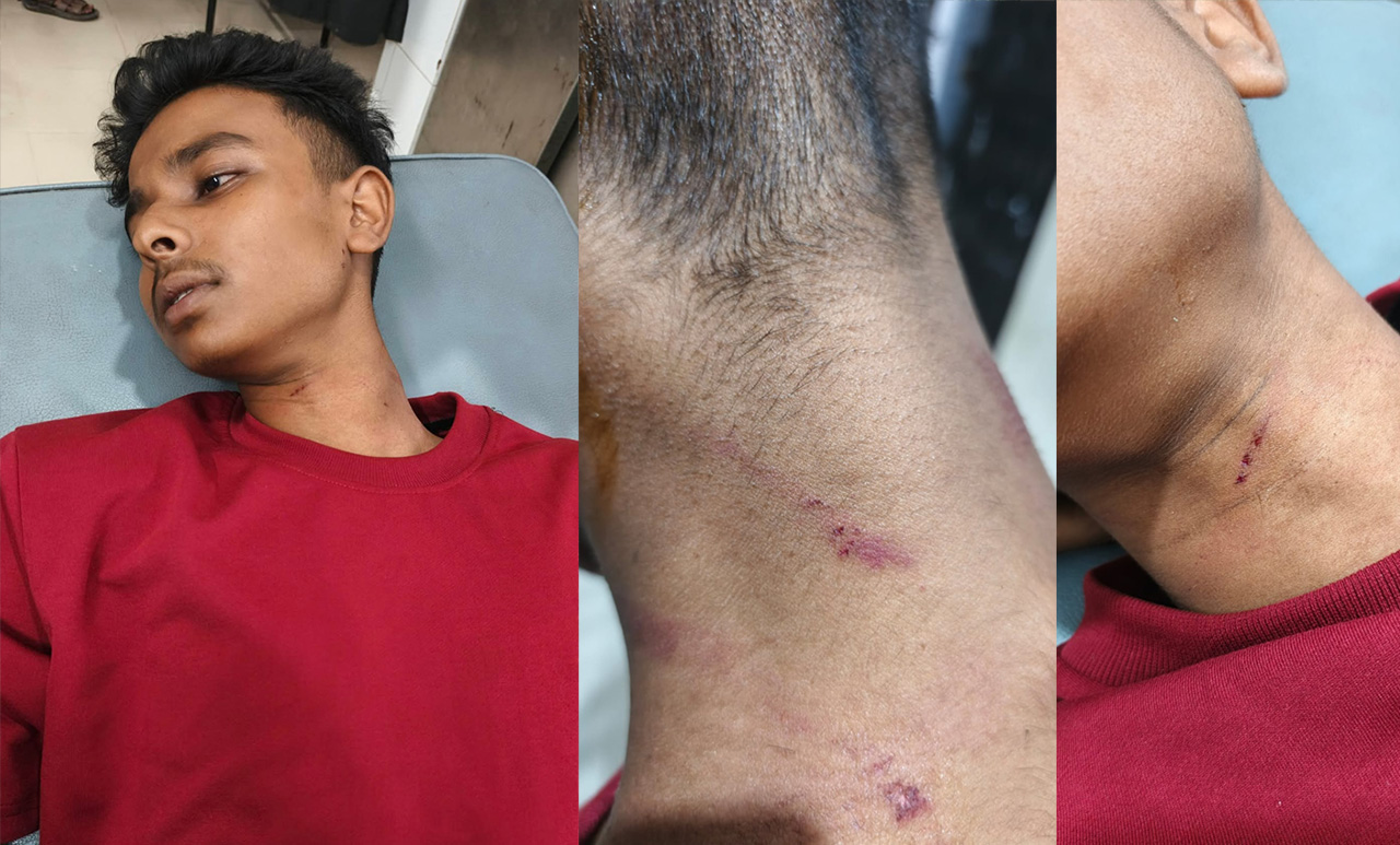 কেশবপুরে তেল পাম্পে অনিয়মের প্রতিবাদে কিশোরকে মারধর, সাংবাদিককে হত্যার হুমকি