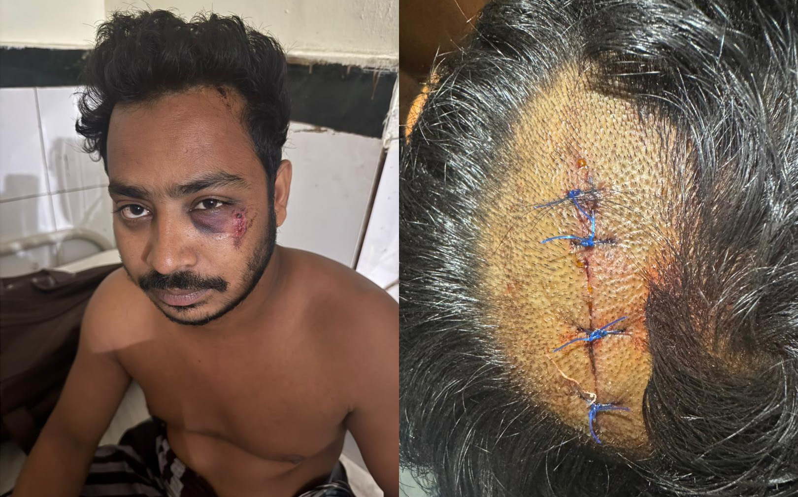 পুরাতন সাতক্ষীরায় রাস্তা দখলের প্রতিবাদ করায় যুবককে কু/পি/য়ে জখম